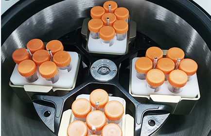 Cómo elegir el tubo de centrífuga