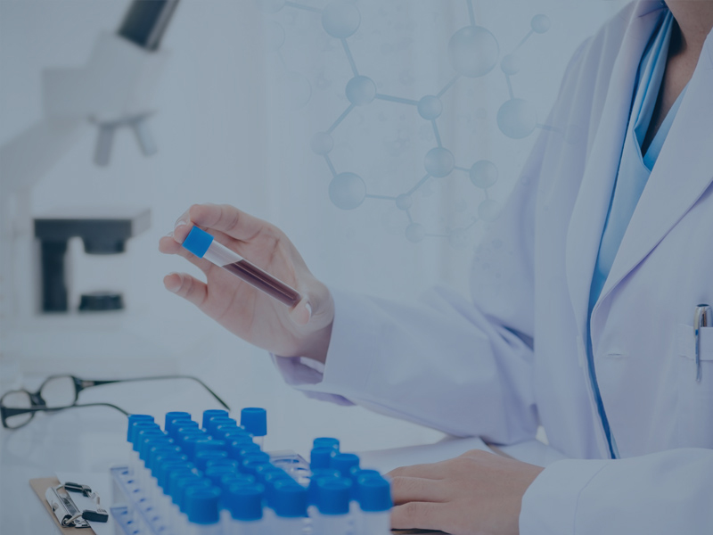 Cito centrífugo utilizado en Inmunofenotipado