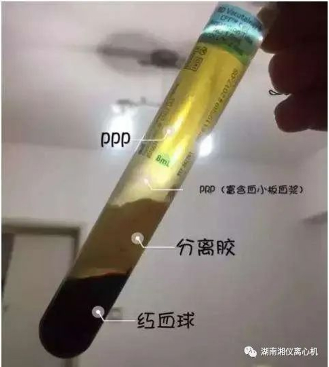 【Popularización de la cientía】 PRP Suero autólogo Belleza